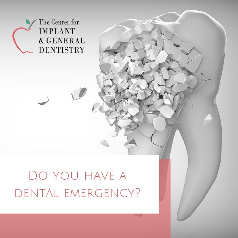 Best Emergency Dentists Lindale - Tyler TX - Center for Implants & General Dentistry